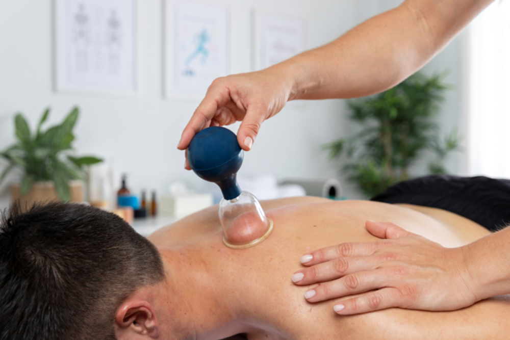 Cupping